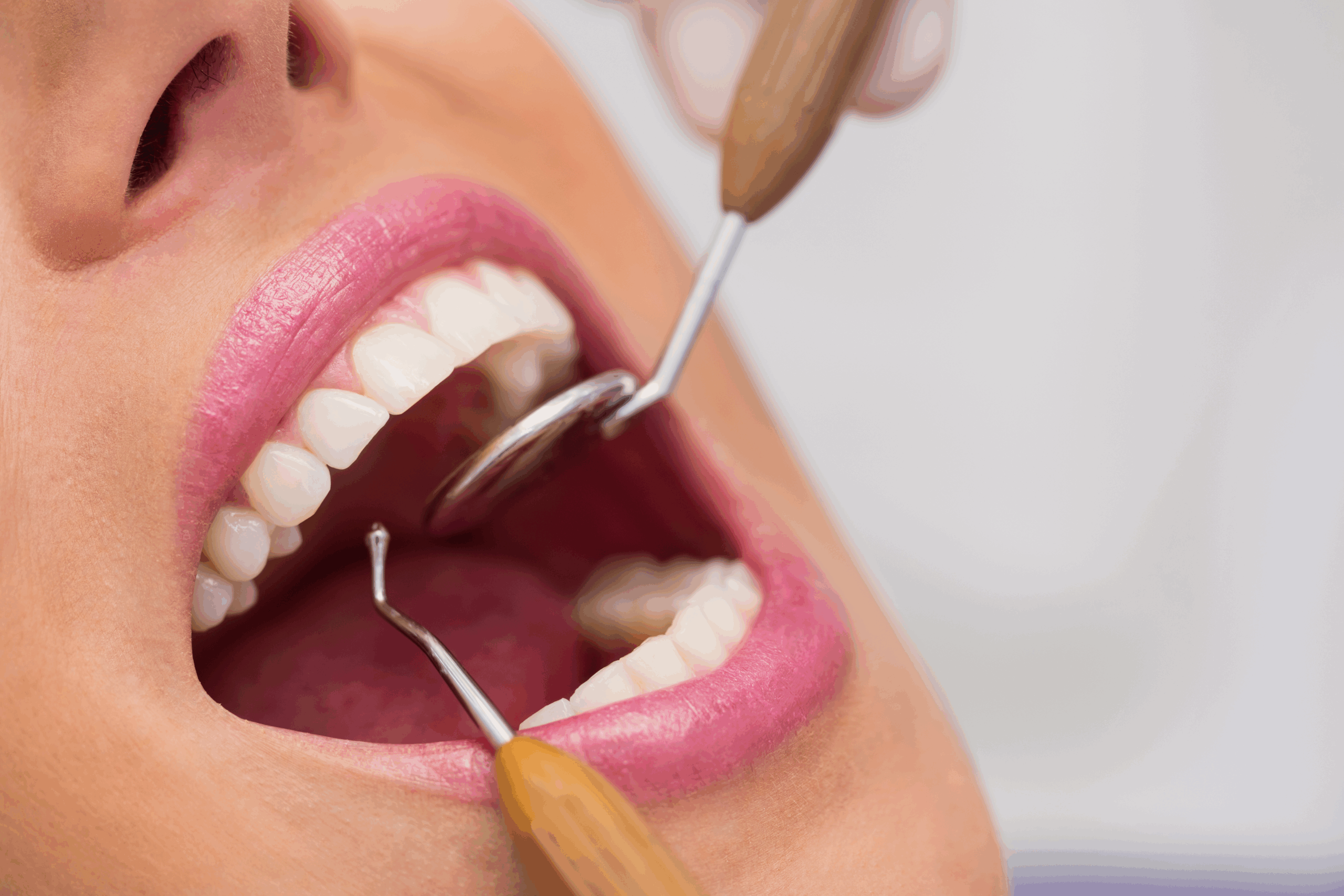 Zahnfleisch Behandlung Ulmadent